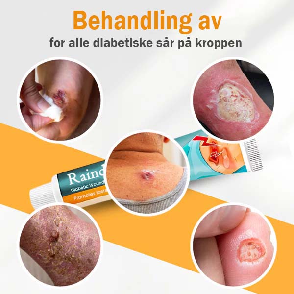 Raindew™🔥Diabetisk sårbehandlingskrem - Kjøp 1 få 1 - 🚨{Begrenset lager}🚨