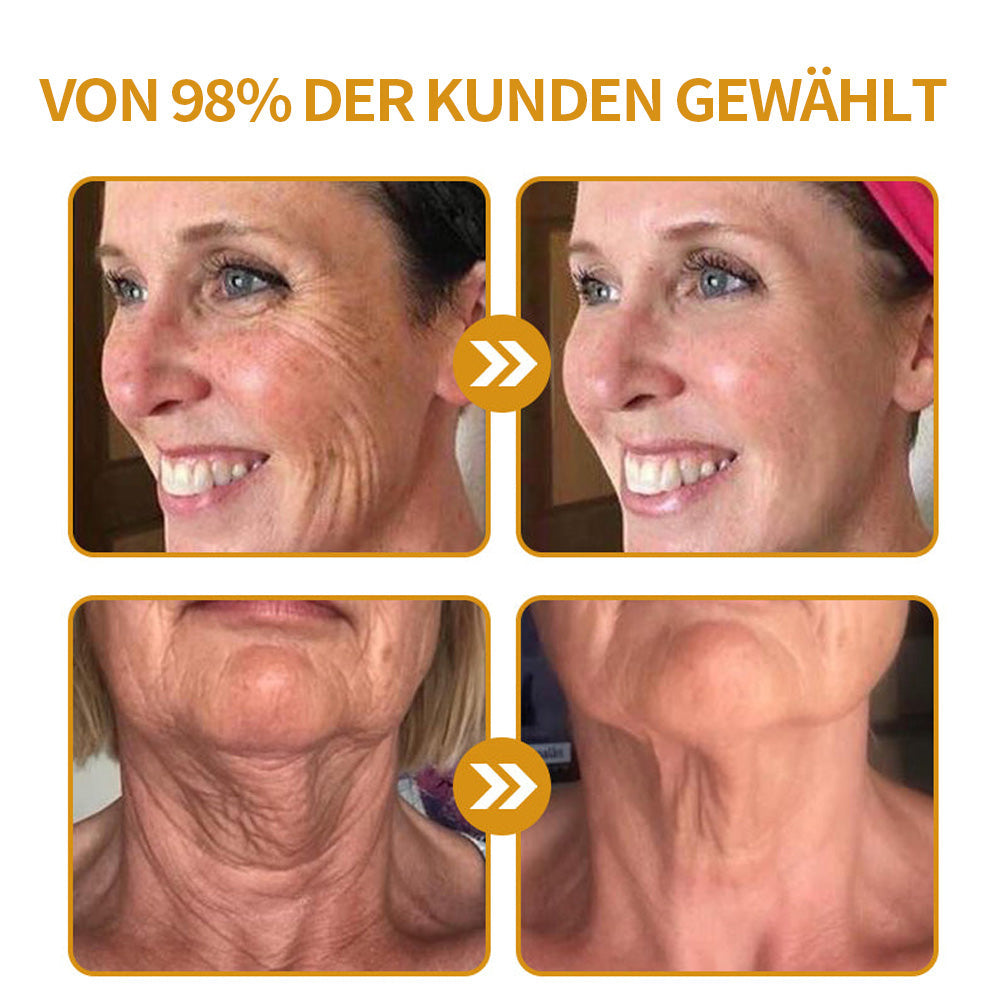Faltenfrei in Minuten: Coolord® 🔥Hautstraffungs-Wunder für reife Haut