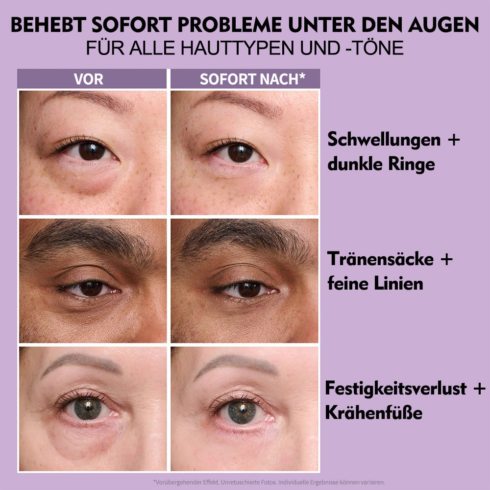 Final 3 Hours: 60%OFF🔥 Instant Eye Tightener Easy-Wear Formula With Brush Free!
