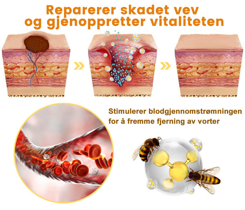 Raindew™ Bie Gift Behandlingskrem (🔥Siste dag, 80 % rabatt)
