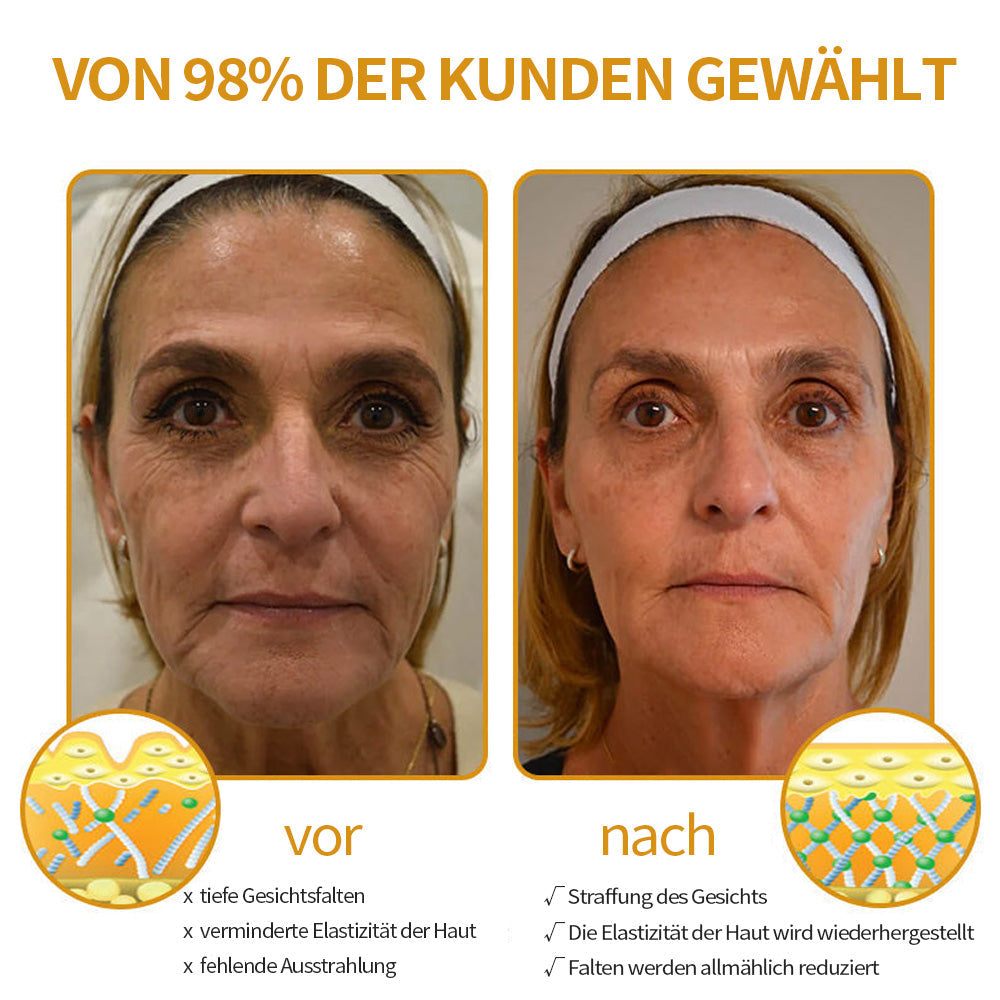Faltenfrei in Minuten: Coolord® 🔥Hautstraffungs-Wunder für reife Haut
