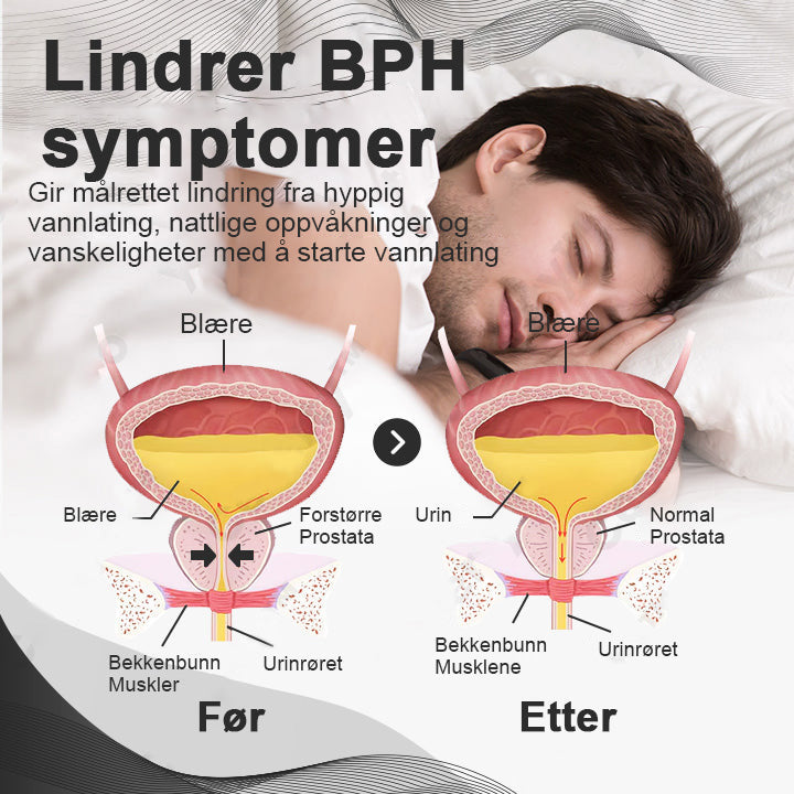 HERMSA™ CopperMag Prostaat Therapie Ring