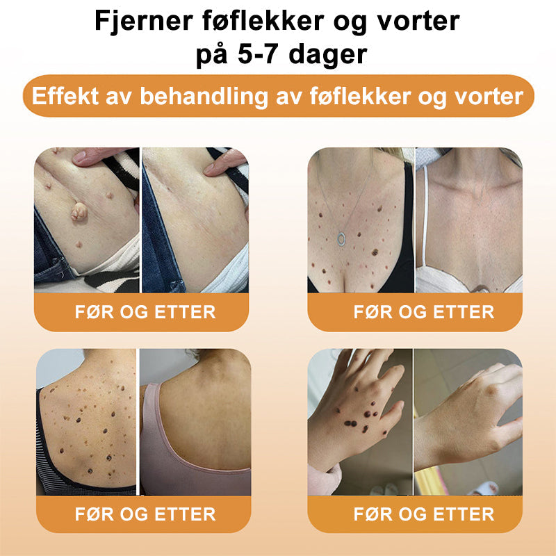 Raindew™ Bie Gift Behandlingskrem (🔥Siste dag, 80 % rabatt)