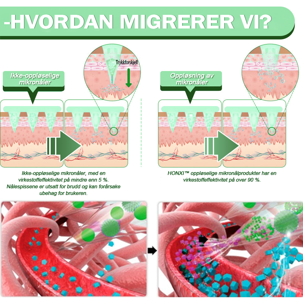 Honxi™ SMGT-GLP-1 Nano mikronål Patch 2.0👩⚕️ (Smertefri, langvarig, adressering av diabetes, fedme og hjerte- og karsykdommer)