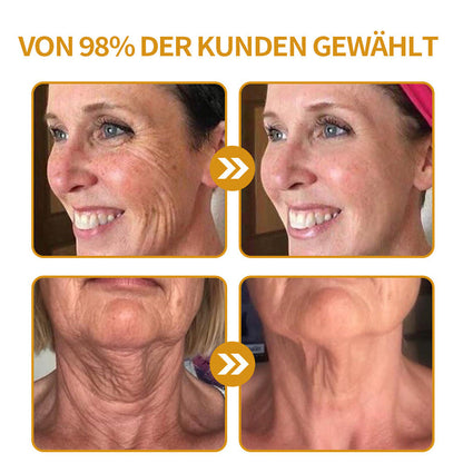 Faltenfrei in Minuten: Coolord® 🔥Hautstraffungs-Wunder für reife Haut