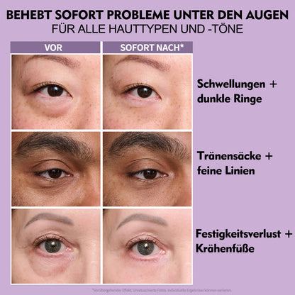 Final 3 Hours: 60%OFF🔥 Instant Eye Tightener Easy-Wear Formula With Brush Free!