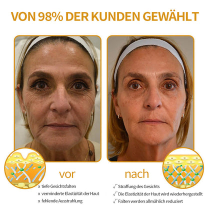 Faltenfrei in Minuten: Coolord® 🔥Hautstraffungs-Wunder für reife Haut